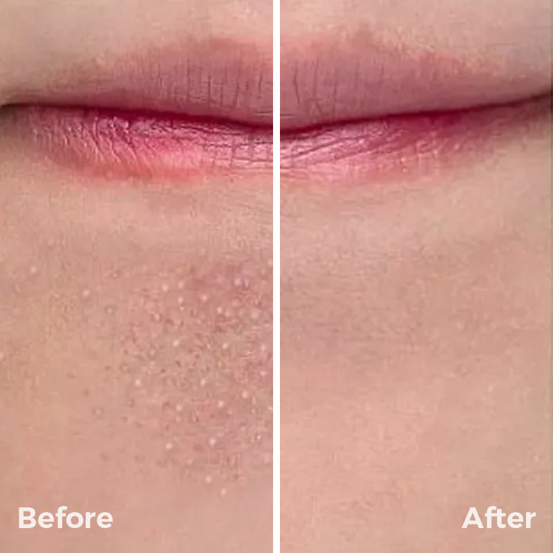 GlowTech PurePore Pro Suction Cleanser™