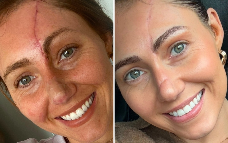 GlowTech premium 8 in 1 Led face mask™