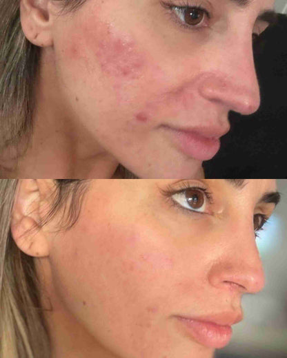 GlowTech LumiSkin Rejuvenation LED Mask™