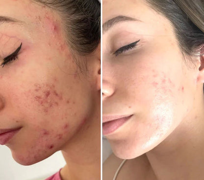 GlowTech DermaWave 7-in-1 LED Therapy Massager™